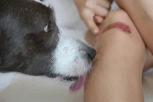 Do Dog licks heal human wounds